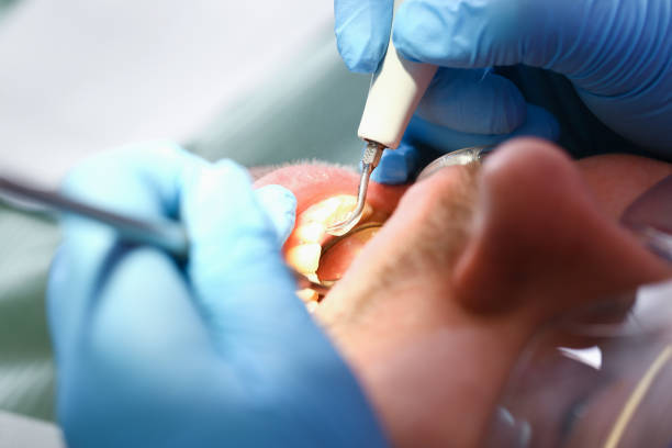 Best Emergency Dental Clinic in MS